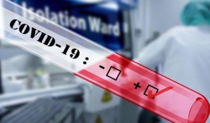 Лабораторно підтверджено 35 нових випадків COVID-19 в області